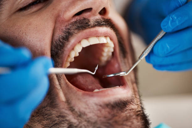 Best Emergency Orthodontic Repairs in La Presa, CA