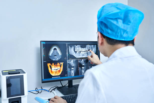 Best Dental Abscess Treatment in La Presa, CA