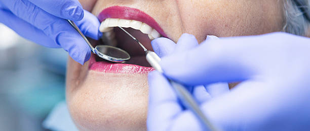 Best Urgent Dental Care for Toothaches in La Presa, CA